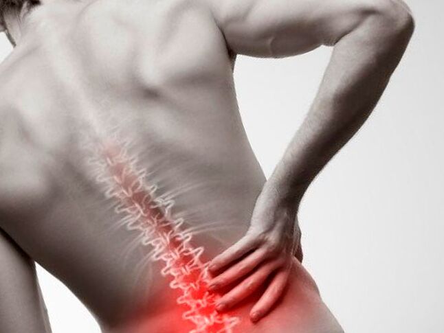 dolor lumbar debido a la osteocondrosis