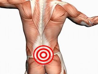 Osteocondrosis de la columna lumbar.