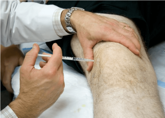 Administración intraarticular de analgésicos en dolor severo